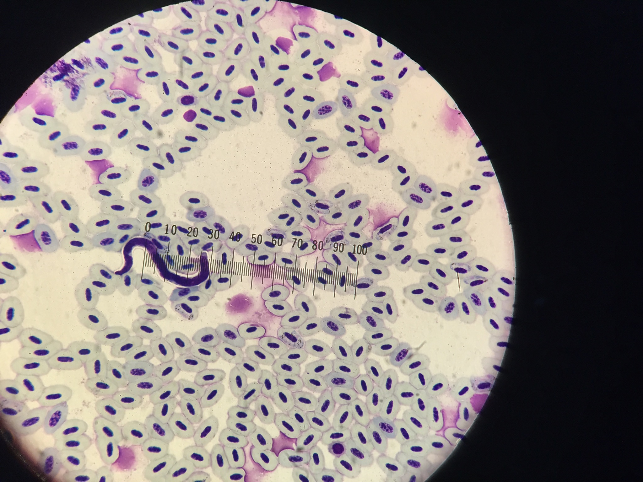 bird blood parasites